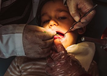 Root Canal Treatment